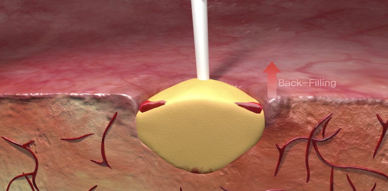 Mechanism-of-action animation still